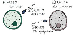 Infografik von Befruchtung der Eizelle durch ein Spermium