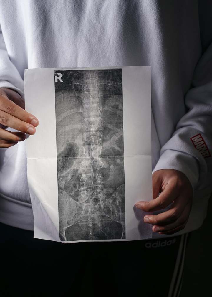 xray xray
